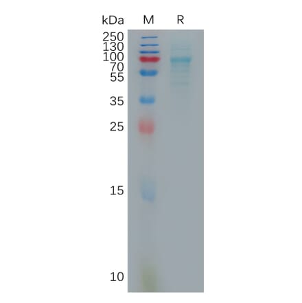 SDS-PAGE - Recombinant Human CXCL16 Protein (Fc Tag) (A317876) - Antibodies.com