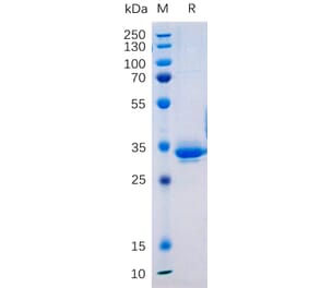 SDS-PAGE - Recombinant Human Transmembrane 4 L6 Family Member 1 Protein (Fc Tag) (A317877) - Antibodies.com