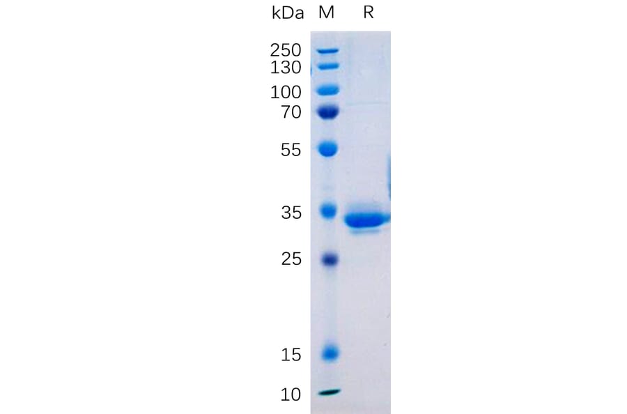 SDS-PAGE - Recombinant Human Transmembrane 4 L6 Family Member 1 Protein (Fc Tag) (A317877) - Antibodies.com