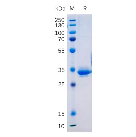 SDS-PAGE - Recombinant Human Transmembrane 4 L6 Family Member 1 Protein (Fc Tag) (A317877) - Antibodies.com