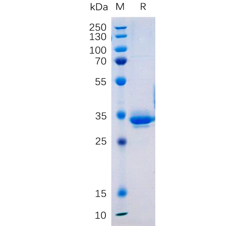 SDS-PAGE - Recombinant Human Transmembrane 4 L6 Family Member 1 Protein (Fc Tag) (A317877) - Antibodies.com