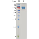 SDS-PAGE - Recombinant Human IL-2RG Protein (Fc Tag) (A317878) - Antibodies.com