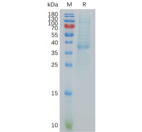 SDS-PAGE - Recombinant Human BCA1 Protein (Fc Tag) (A317879) - Antibodies.com