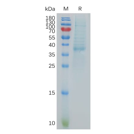 SDS-PAGE - Recombinant Human BCA1 Protein (Fc Tag) (A317879) - Antibodies.com