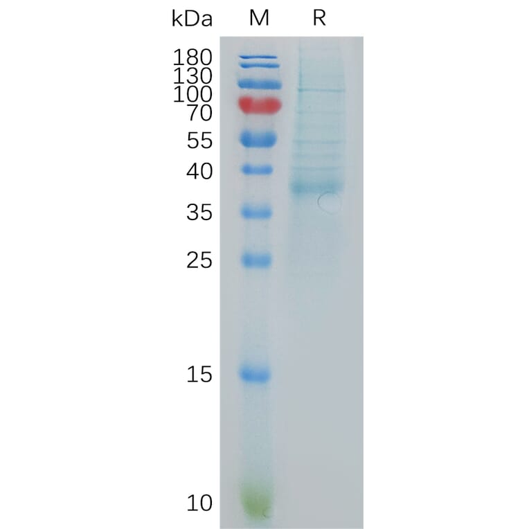 SDS-PAGE - Recombinant Human BCA1 Protein (Fc Tag) (A317879) - Antibodies.com