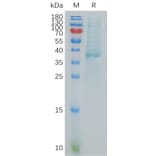 SDS-PAGE - Recombinant Human BCA1 Protein (Fc Tag) (A317879) - Antibodies.com