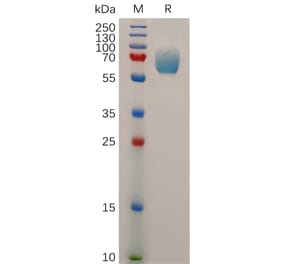 SDS-PAGE - Recombinant Human IFNGR1 Protein (Fc Tag) (A317880) - Antibodies.com