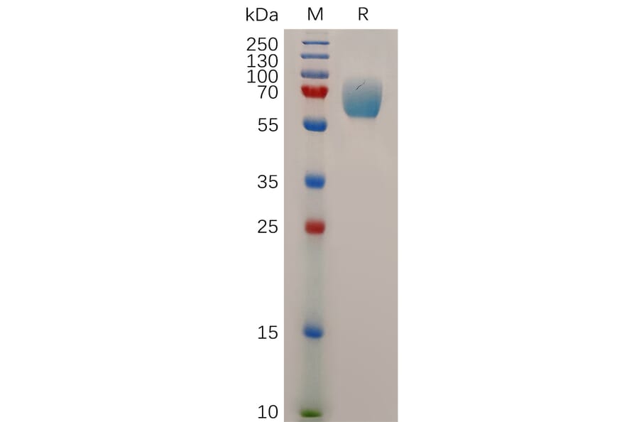 SDS-PAGE - Recombinant Human IFNGR1 Protein (Fc Tag) (A317880) - Antibodies.com