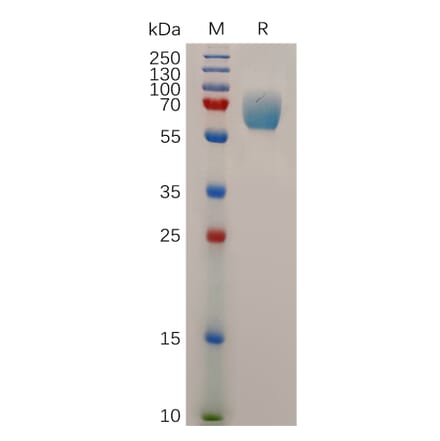 SDS-PAGE - Recombinant Human IFNGR1 Protein (Fc Tag) (A317880) - Antibodies.com