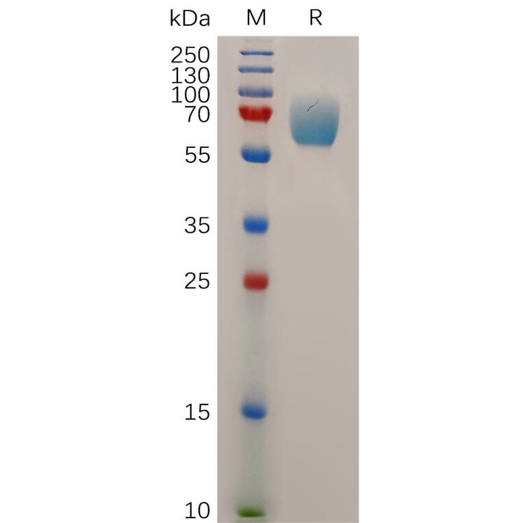 SDS-PAGE - Recombinant Human IFNGR1 Protein (Fc Tag) (A317880) - Antibodies.com