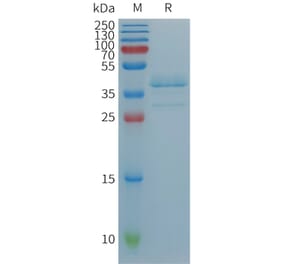 SDS-PAGE - Recombinant Human TGF alpha Protein (Fc Tag) (A317881) - Antibodies.com