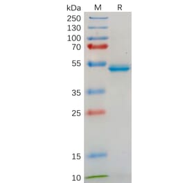 SDS-PAGE - Recombinant Human IL-18 Protein (Fc Tag) (A317882) - Antibodies.com