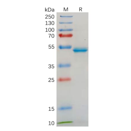 SDS-PAGE - Recombinant Human IL-18 Protein (Fc Tag) (A317882) - Antibodies.com