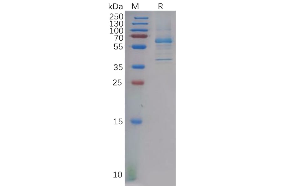 SDS-PAGE - Recombinant Human DKK2 Protein (Fc Tag) (A317887) - Antibodies.com
