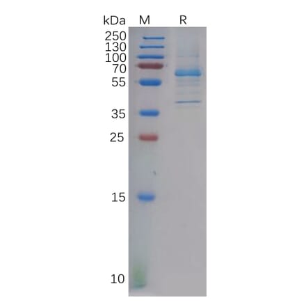 SDS-PAGE - Recombinant Human DKK2 Protein (Fc Tag) (A317887) - Antibodies.com