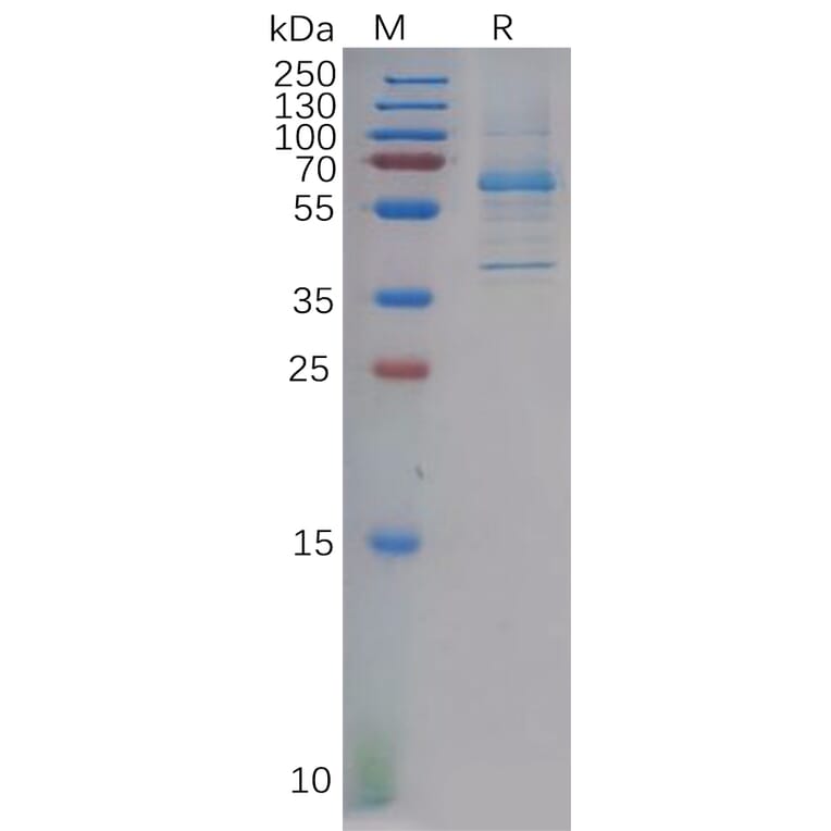 SDS-PAGE - Recombinant Human DKK2 Protein (Fc Tag) (A317887) - Antibodies.com