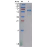 SDS-PAGE - Recombinant Human DKK2 Protein (Fc Tag) (A317887) - Antibodies.com