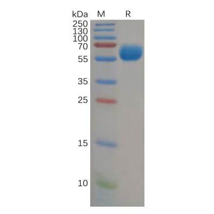 SDS-PAGE - Recombinant Human VISTA Protein (Fc Tag) (A317888) - Antibodies.com