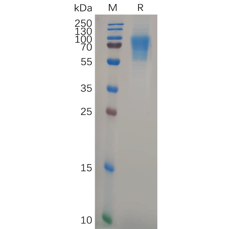 SDS-PAGE - Recombinant Human CD6/T12 Protein (6×His Tag) (A317889) - Antibodies.com