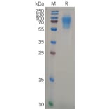 SDS-PAGE - Recombinant Human CD6/T12 Protein (6×His Tag) (A317889) - Antibodies.com