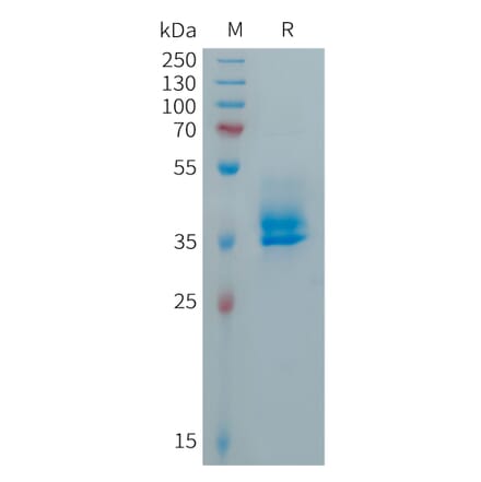 SDS-PAGE - Recombinant Human Calcitonin Protein (Fc Tag) (A317890) - Antibodies.com