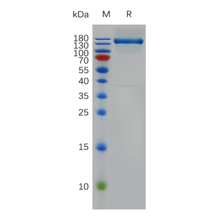 SDS-PAGE - Recombinant Human VEGF Receptor 1 Protein (Fc Tag) (A317892) - Antibodies.com