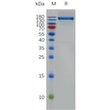 SDS-PAGE - Recombinant Human VEGF Receptor 1 Protein (Fc Tag) (A317892) - Antibodies.com