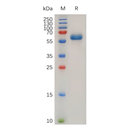 SDS-PAGE - Recombinant Human TNF Receptor I Protein (Fc Tag) (A317894) - Antibodies.com