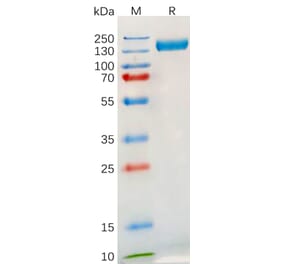 SDS-PAGE - Recombinant Human TLR3 Protein (Fc Tag) (A317895) - Antibodies.com
