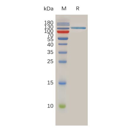 SDS-PAGE - Recombinant Human SPAM1 Protein (Fc Tag) (A317896) - Antibodies.com