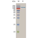 SDS-PAGE - Recombinant Human SPAM1 Protein (Fc Tag) (A317896) - Antibodies.com