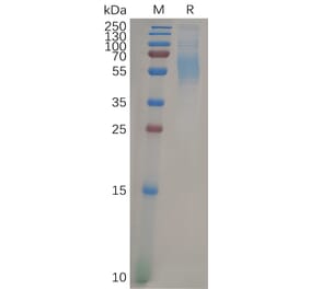 SDS-PAGE - Recombinant Human SIGLEC9 Protein (6×His Tag) (A317897) - Antibodies.com