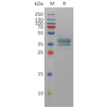 SDS-PAGE - Recombinant Human Prostaglandin E Receptor EP2/PTGER2 Protein (Fc Tag) (A317901) - Antibodies.com