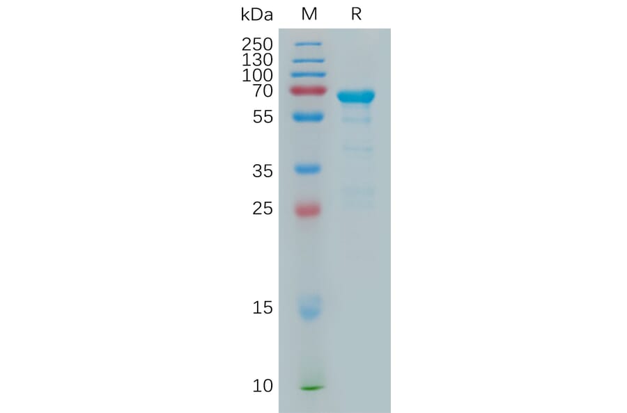 SDS-PAGE - Recombinant Human MMP2 Protein (6×His Tag) (A317902) - Antibodies.com