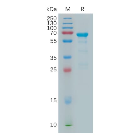 SDS-PAGE - Recombinant Human MMP2 Protein (6×His Tag) (A317902) - Antibodies.com