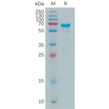 SDS-PAGE - Recombinant Human MMP2 Protein (6×His Tag) (A317902) - Antibodies.com