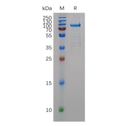 SDS-PAGE - Recombinant Human MMP11 Protein (Fc Tag) (A317903) - Antibodies.com