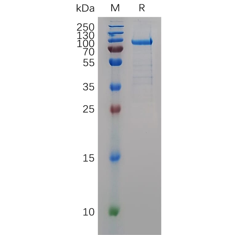 SDS-PAGE - Recombinant Human MMP11 Protein (Fc Tag) (A317903) - Antibodies.com