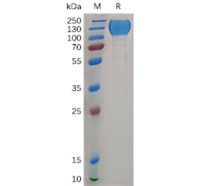 SDS-PAGE - Recombinant Human MERTK Protein (Fc Tag) (A317904) - Antibodies.com