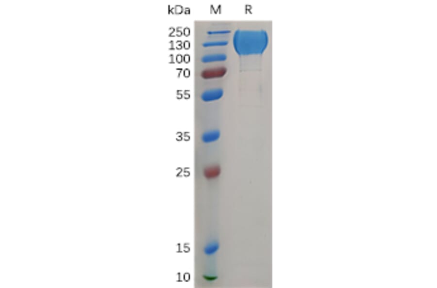 SDS-PAGE - Recombinant Human MERTK Protein (Fc Tag) (A317904) - Antibodies.com