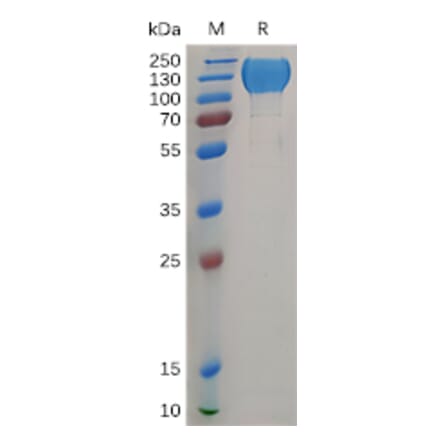 SDS-PAGE - Recombinant Human MERTK Protein (Fc Tag) (A317904) - Antibodies.com