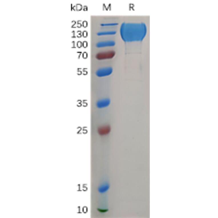 SDS-PAGE - Recombinant Human MERTK Protein (Fc Tag) (A317904) - Antibodies.com