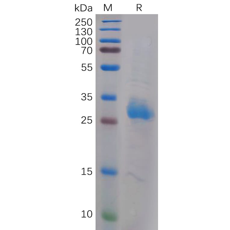 SDS-PAGE - Recombinant Human Galectin 3 Protein (6×His Tag) (A317905) - Antibodies.com