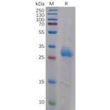 SDS-PAGE - Recombinant Human Galectin 3 Protein (6×His Tag) (A317905) - Antibodies.com