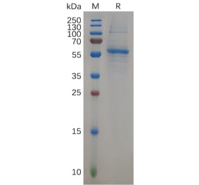 SDS-PAGE - Recombinant Human KRAS Protein (Fc Tag) (A317906) - Antibodies.com