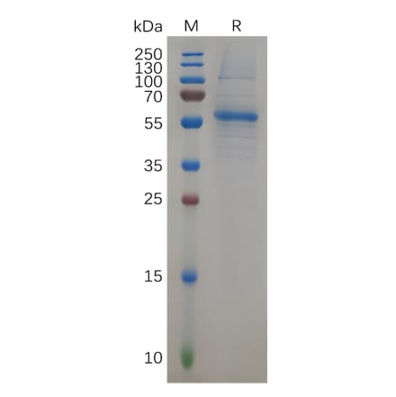 SDS-PAGE - Recombinant Human KRAS Protein (Fc Tag) (A317906) - Antibodies.com