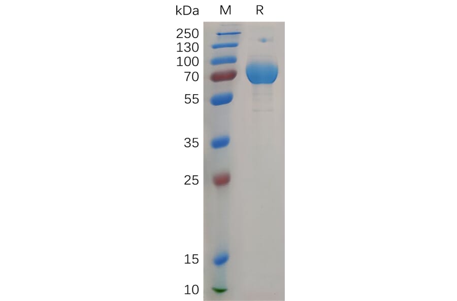 SDS-PAGE - Recombinant Human IFN gamma Receptor beta/AF-1 Protein (Fc Tag) (A317907) - Antibodies.com