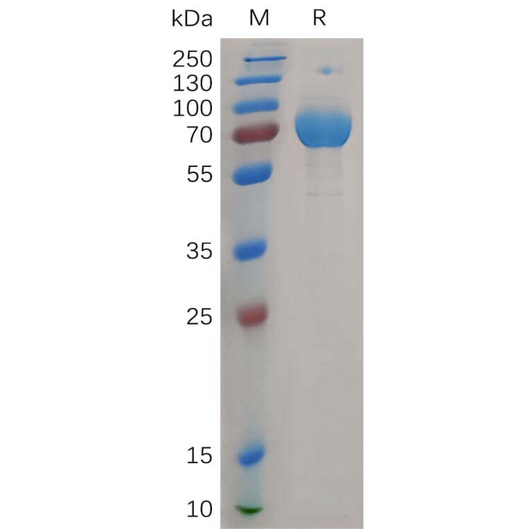 SDS-PAGE - Recombinant Human IFN gamma Receptor beta/AF-1 Protein (Fc Tag) (A317907) - Antibodies.com