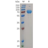 SDS-PAGE - Recombinant Human IFN gamma Receptor beta/AF-1 Protein (Fc Tag) (A317907) - Antibodies.com