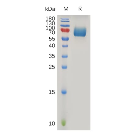 SDS-PAGE - Recombinant Human IFNAR2 Protein (Fc Tag) (A317908) - Antibodies.com